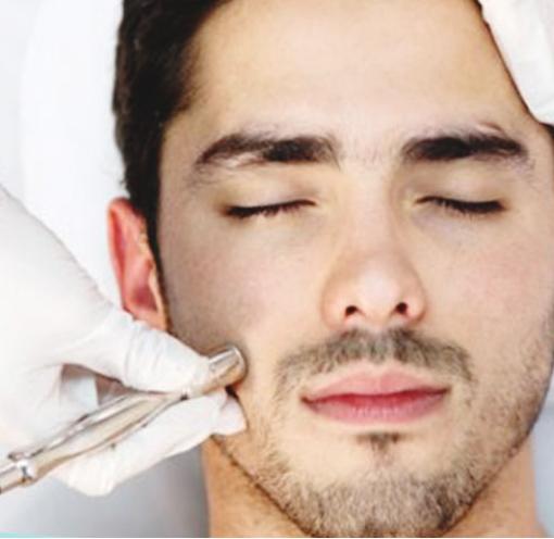 microdermabrasion-male-face