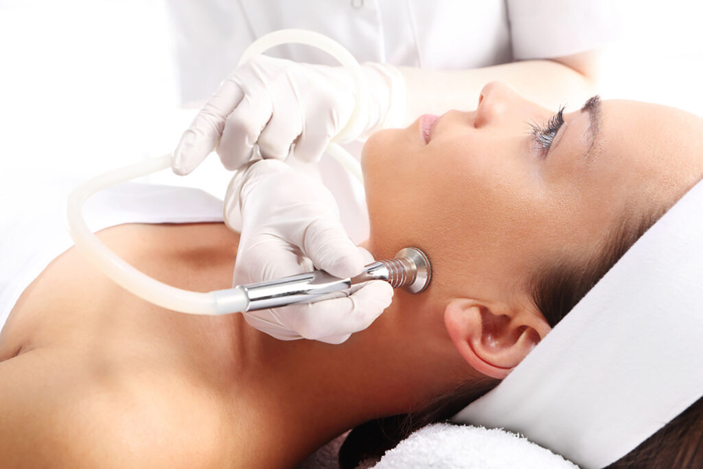 diamond peel