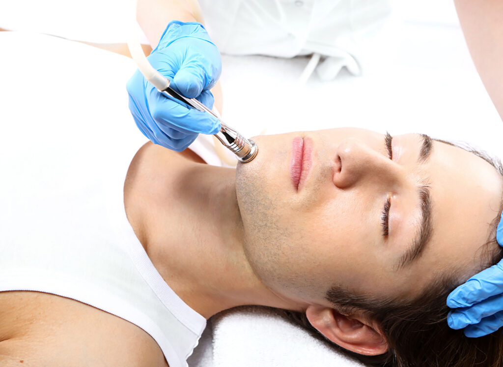 diamond peel experience