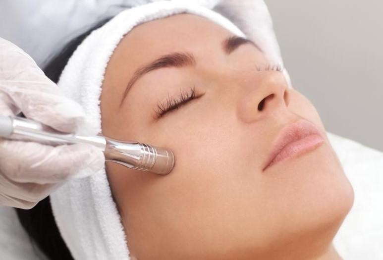 microdermabrasion female