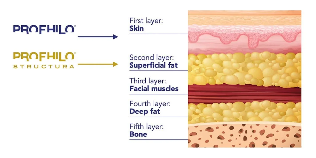 profhilo-vs-profhilo-structura-layers